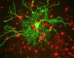 Научни новини: синтетична кожа, регенерация на мозъчна тъкан и органоиден интелект