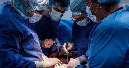 Лекари по време на трансплантация
